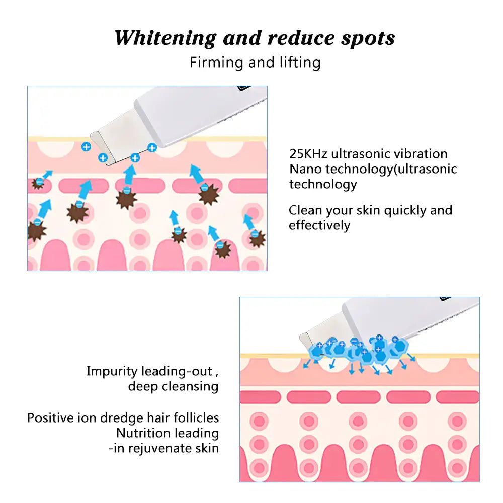 Ultrasonic pore cleanser