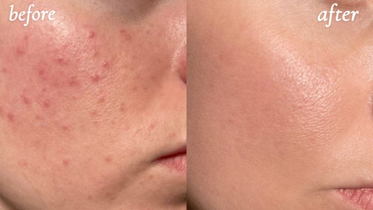 Revive Radiance Wand -Led Therapy And Massage