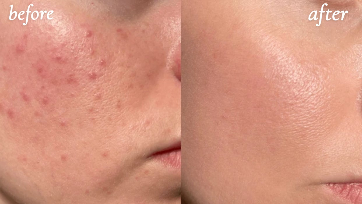 Revive Radiance Wand -Led Therapy And Massage